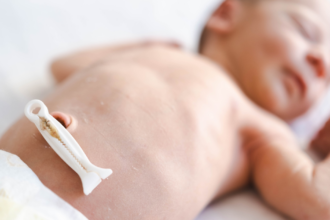 Como limpar o umbigo do bebê