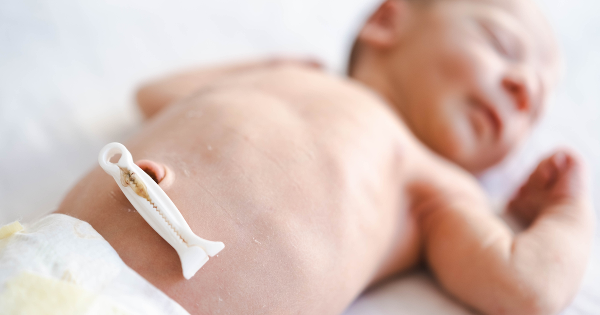 Como limpar o umbigo do bebê