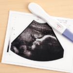 primeiros sintomas da gravidez